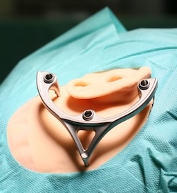 OtoJig Mini-Stereotactic Frame attached on a dummy head, resembling an OR setting.