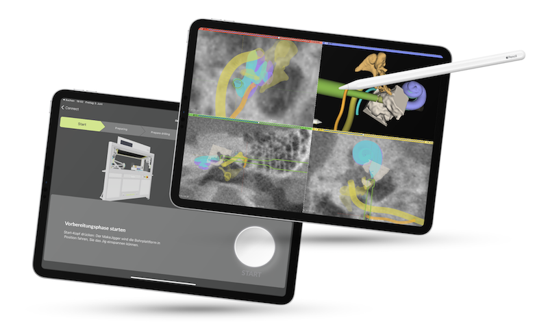 Mockup of the iPad software.