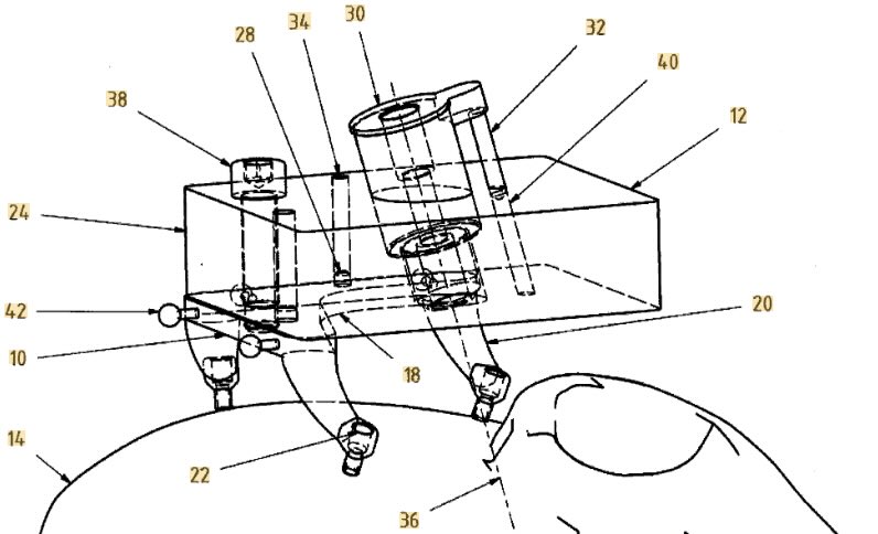 Invention patent drawing showing the jig-based surgical guidance concept